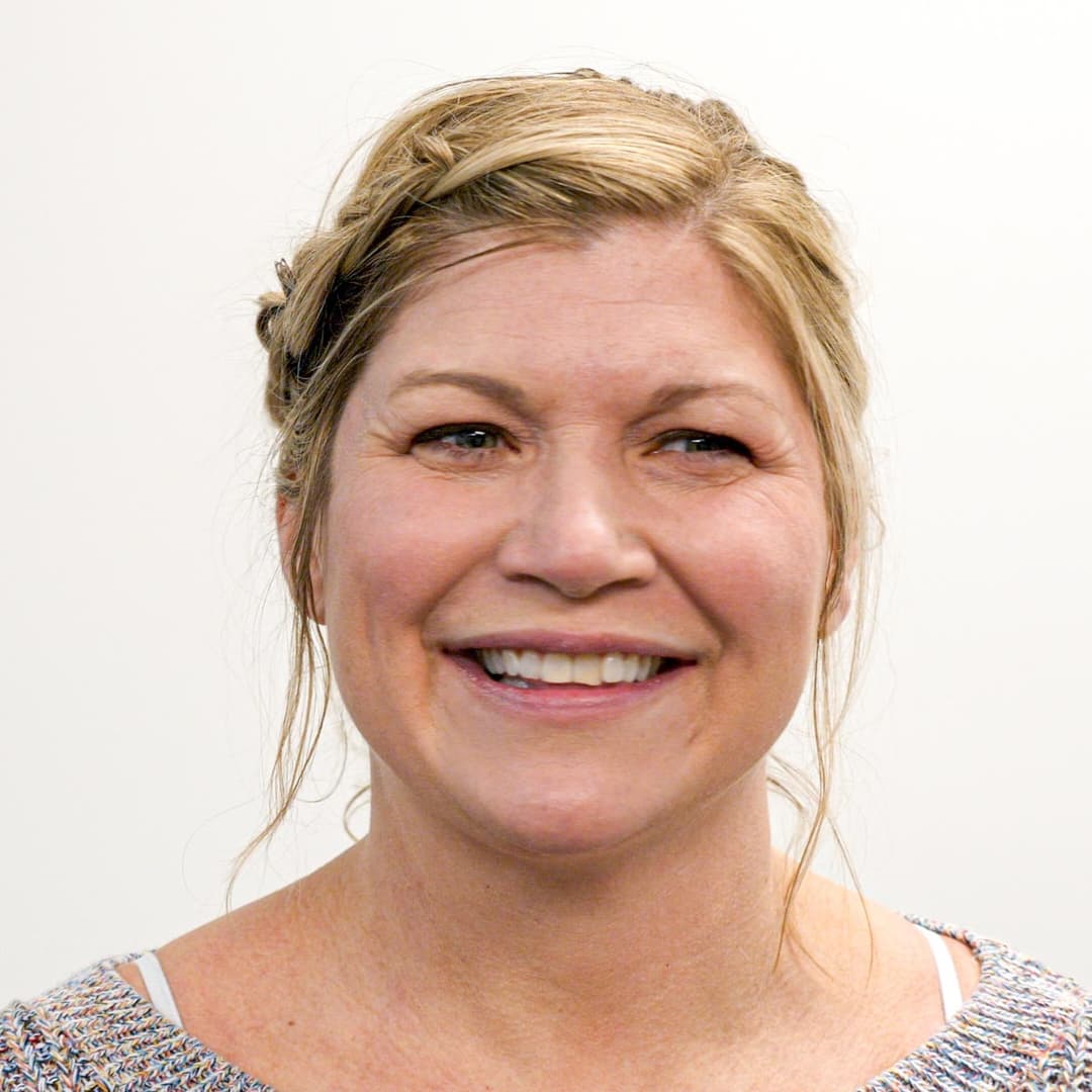 Before image 3 cc/syringes of Restylane in the tear troughs, nasal labial folds and jowls. Also, 2 cc/syringes of Restylane Lyft in the cheeks